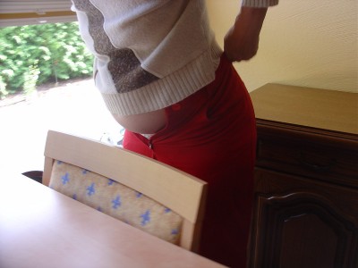 Zyprexa side-effects. Before the &quot;medical treatment&quot; with Zyprexa...those trousers did fit. My aunt was only left with those unfitting ones...